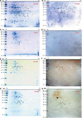 Corrigendum: Identification of Novel Laminin- and Fibronectin-Binding Proteins by Far-Western Blot: Capturing the Adhesins of Streptococcus suis Type 2